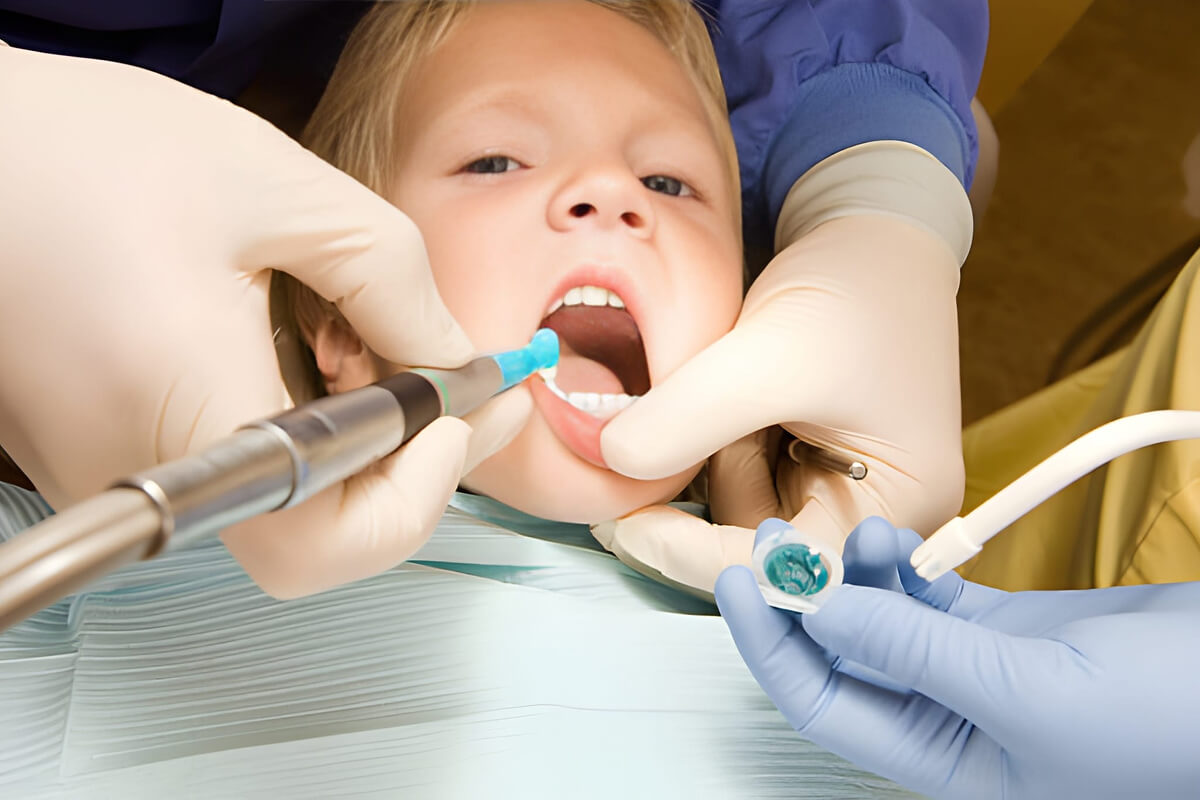 fluoride treatment in macleod