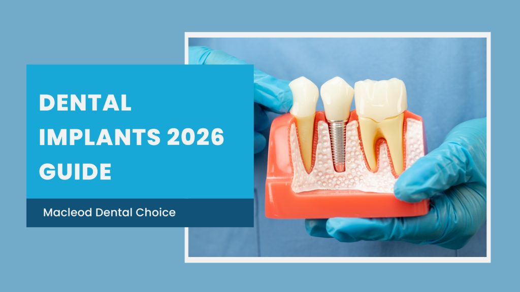 dental implants 2026 guide