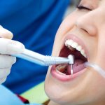 Tooth Extraction Aftercare: The Complete Dos and Don'ts for Fast Healing